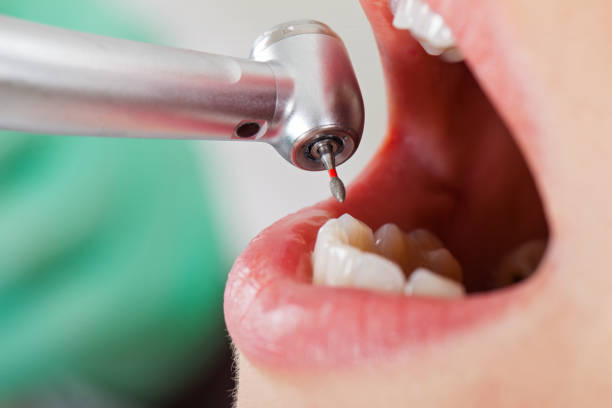 Best Emergency Dental Care for Trauma or Injury in Leo Cedarville, IN